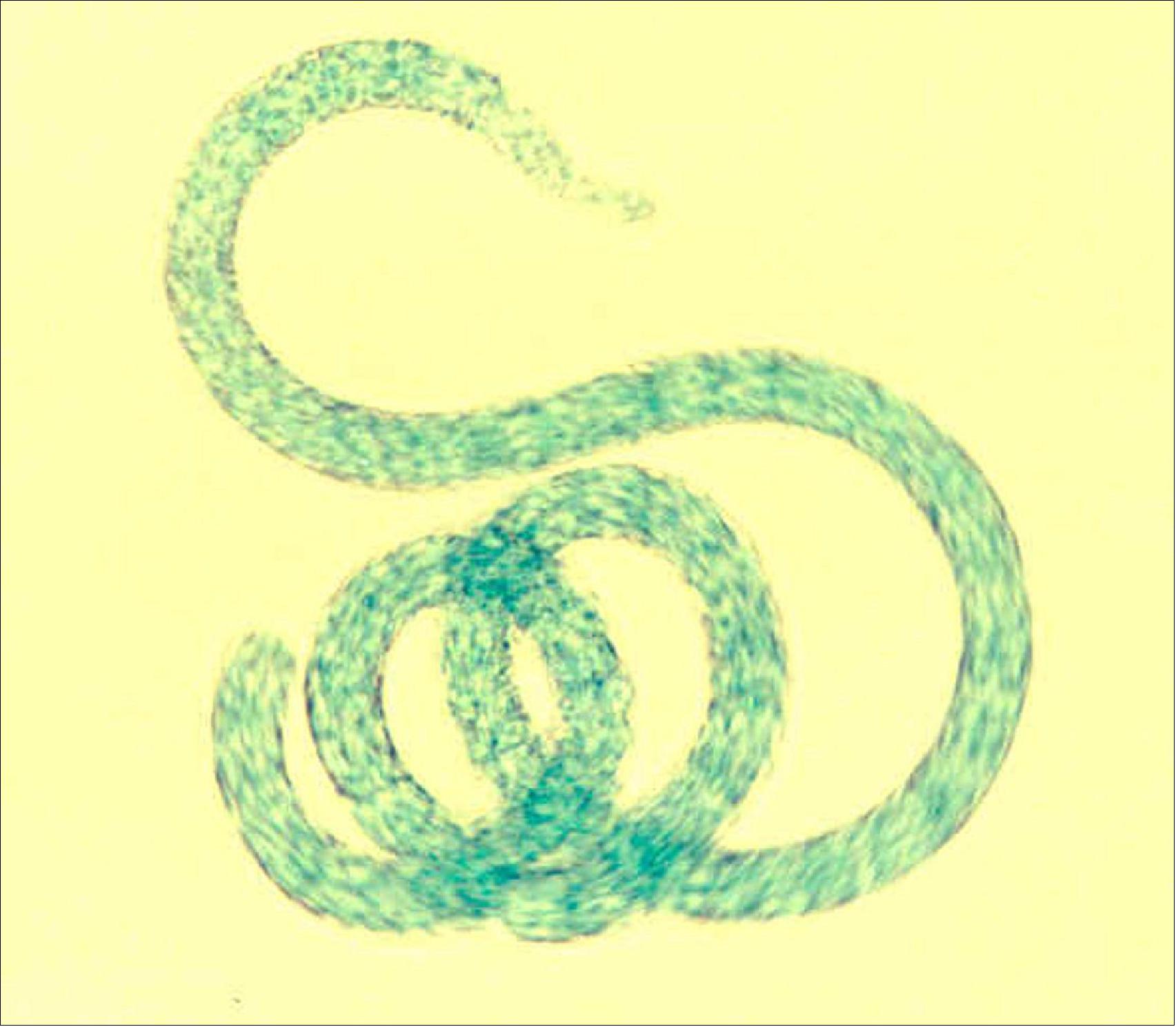 Figure 4: Artist's rendition of spirulina (image credit: ESA)